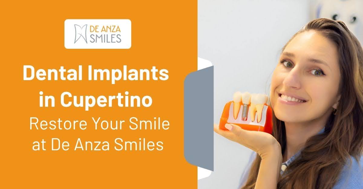 Dental Implants in Cupertino - Restore Your Smile at De Anza Smiles