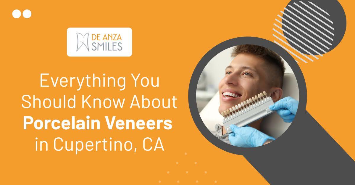 Everything You Should Know About Porcelain Veneers in Cupertino, CA