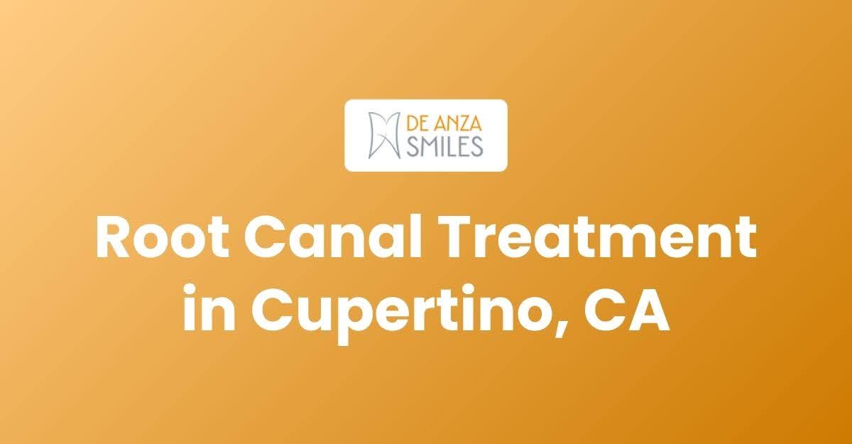 Root Canal Treatment in Cupertino, CA - Everything You Need to Know Before Your Appointment